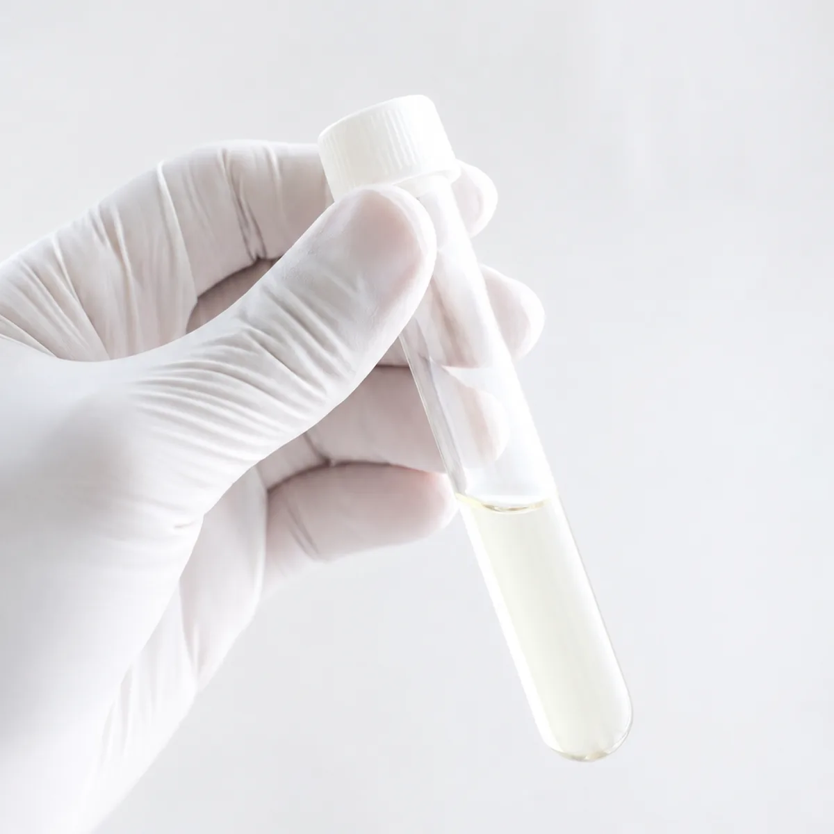 Mão com luva estéril segurando um tubo com amostra de líquor